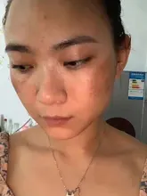 Crema blanqueadora para pecas, crema facial de hierbas chinas, elimina pecas y manchas oscuras, 30g