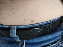 Kit de eliminación de verrugas y microbanda para la piel, eliminador de verrugas con hisopo de limpieza, topos y verrugas para adultos, cuidado facial