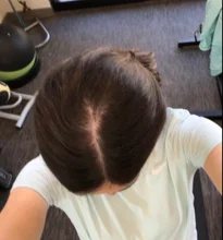HAIRCUBE-esencia para el crecimiento del cabello para hombres y mujeres, suero para el crecimiento del cabello, Germinal rápido, cuidado del cabello, reparación, líquido antipérdida de cabello más grueso