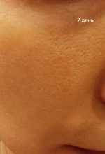 Liberex-cepillo de limpieza Facial sónico, limpiador Facial eléctrico, resistente al agua, suave, masaje de poros profundo, 3 cabezales, 3 modos de carga inalámbrica