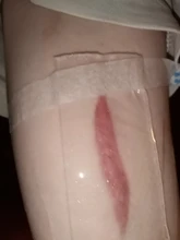 De silicona de parche de Gel para el acné cicatriz terapia del parche de lámina para eliminar quemaduras y golpes Reparación DE LA PIEL 88 @ 88 WH998