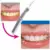 SONIC PIC purpose cleaner DENTAL ULTRASONICO Tartar smudge stick placa зубы 3000 вибраций в минуту