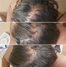 Aceite de esencia de crecimiento de pelo rápido, suero para el crecimiento del cabello de jengibre, tratamiento nutritivo para suavizar la pérdida de cabello, reparación de cabello dañado, 10/30ML, 7 días