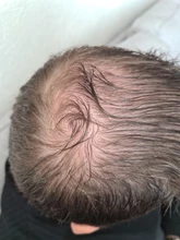 Aplicador de queratina para la pérdida del cabello, polvos de fibra de construcción para el crecimiento del cabello, Spray de estilismo, extensión de polvo de Color para adelgazamiento