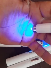 Lápiz láser para tratamiento de venas varicosas, lápiz láser para tratamiento de eliminación de cicatrices, arrugas, acné, masaje relajante