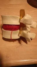 Modelo de accesorios médicos, gastos de envío gratis, columna anatómica, disco Lumbar, hernia, anatomía, herramienta de enseñanza médica