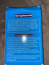 Kit de eliminación de verrugas y microbanda para la piel, eliminador de verrugas con hisopo de limpieza, topos y verrugas para adultos, cuidado facial