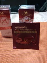 Esencia rápida y potente para el crecimiento del cabello, productos para la pérdida del cabello, tratamiento líquido de aceite esencial, productos para el cuidado del cabello, 20ml