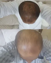 PURC-pulverizador para el crecimiento del cabello para hombres y mujeres, tratamiento para la pérdida de cabello de rápido crecimiento, productos de belleza para el cuidado del cabello, 30ml