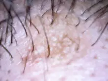 Cámara Dental inalámbrica con WiFi, endoscopio Intraoral ajustable, 1080p, HD, 8 luces LED, Cable USB, herramienta de inspección bucal para dentista