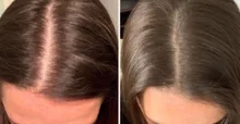 Champú y acondicionador para el crecimiento del cabello con queratina brasileña, conjunto para mejorar el crecimiento del cabello, regalos, previene el cuidado de las mujeres de 200ml