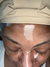 Almohadilla de silicona antiarrugas para el cuidado de la piel, almohadillas médicas reutilizables, antiedad, prevención de arrugas, Estiramiento facial, herramientas de belleza