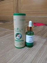 Aceite Esencial de rinoplastia para Realce de nariz, aceite esencial Natural puro para el cuidado de la nariz, fino, más pequeño, 100% efectiva