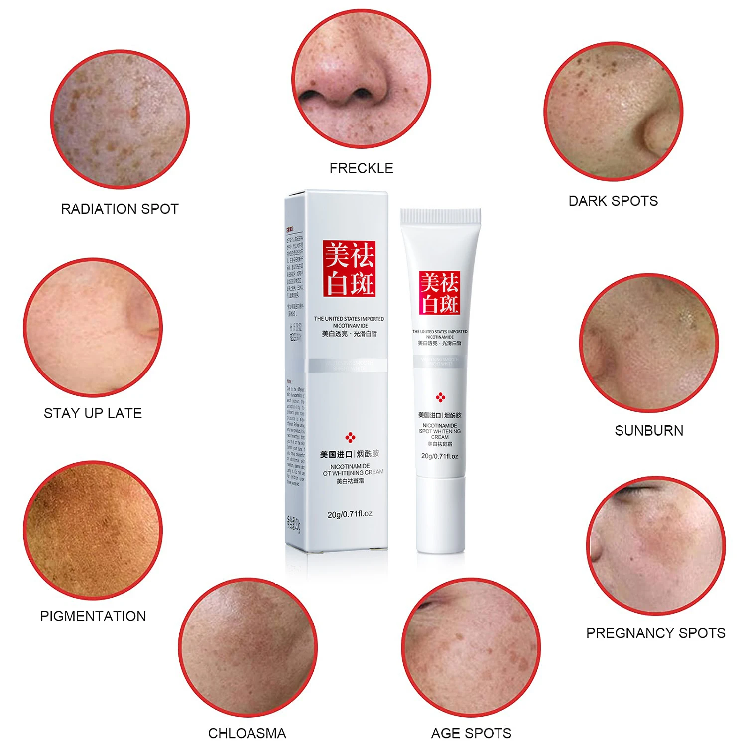 Whitening Freckle Cream Remove Melasma Acne Spot Pigment Melanin Dark Spots Pigmentation Freckle Removal Cream Moisturizing Gel