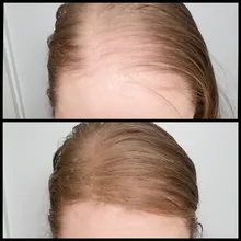 Fibras de queratina para el cabello, Spray espesante de fibras de reconstrucción del cabello, 27,5g, polvos instantáneos, peine aplicador