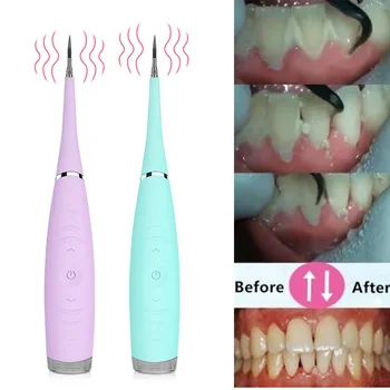 

Electric Dental Scaler Sonic Silicone Tooth Cleaner Rechargeable USB Tooth Calculus Remover Stains Tartar Remover
