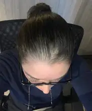 HAIRCUBE-tratamiento para el crecimiento del cabello para mujeres y hombres, aceite esencial de esencia antipérdida de cabello, suero para el cuidado del cuero cabelludo, aceite esencial Biotech de crecimiento rápido