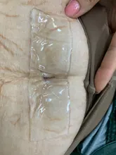 De silicona de parche de Gel para el acné cicatriz terapia del parche de lámina para eliminar quemaduras y golpes Reparación DE LA PIEL 88 @ 88 WH998