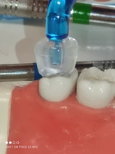 Kit de molde de impresión Dental Posterior, herramientas de llenado de restauración Dental