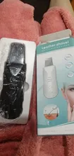 Depurador ultrasónico para piel, limpieza Facial profunda, vibrador, limpieza Facial, espátula, pelador, dispositivo de belleza