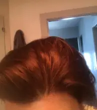 Champú para el crecimiento del cabello para hombres y mujeres, conjunto de regalo, espesante, productos para el cuidado de la caída del cabello, tratamiento de crecimiento del cabello, aceite SÉRUM