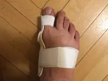 Juanete férula del dedo gordo del pie plancha Corrector de pie alivio del dolor del Hallux Valgus corrección ortopédicos suministros pedicura para el cuidado de los pies
