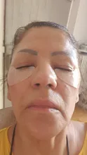 Parche ocular de microagujas para eliminación de arrugas finas, ácido hialurónico, mascarilla para ojos, ojeras, hinchazón, almohadillas para los ojos, 1 par