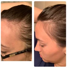 HAIRCUBE-esencia para el crecimiento del cabello para hombres y mujeres, suero para el crecimiento del cabello, Germinal rápido, cuidado del cabello, reparación, líquido antipérdida de cabello más grueso