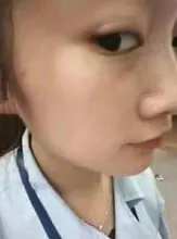 Crema blanqueadora para pecas, crema facial de hierbas chinas, elimina pecas y manchas oscuras, 30g