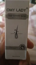 OMY LADY-aerosol para el crecimiento del cabello, aceite esencial líquido para hombres y mujeres, reparación y cuidado de la regeneración del cabello seco