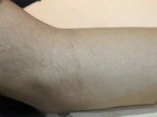 Máquina de depilación láser de diodo de alta energía, 808nm, Para rejuvenecimiento de la piel, 808nm, máquina de depilación indolora, envío gratis