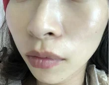 Freckle-Removal-Cream Whitening Remove-Freckle Melanin Dark-Spot Anti-Aging Omy Lady