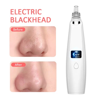 

Blackhead Remover Acne cleaner Vacuum Pore Comedones Removal Facial Pimples cleaning Tools set with 6 changeable beauty heads