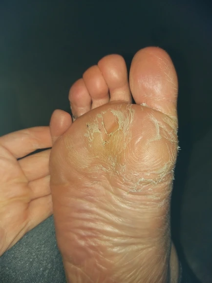 1pack Peeling Feet Mask Exfoliating Socks Care Pedicure Socks Remove Dead Skin Cuticles Foot Mask Heel Socks For Pedicure Exfoliating Socks Socks For Pedicurepedicure Socks Aliexpress 1pack Peeling Feet Mask Exfoliating Socks Care Pedicure Socks Remove Dead Skin Cuticles Foot Mask Heel Socks For Pedicure Exfoliating Socks Socks For Pedicurepedicure Socks Aliexpress