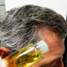 Aceite potente para el crecimiento del cabello para hombres y mujeres, productos para evitar la pérdida del cabello, tratamiento líquido de esencia, champú reparador, cuidado del cabello, 20ml