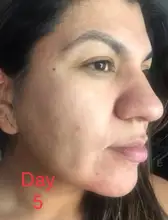 Suero facial con ampolla de vitamina C, blanqueador, antiarrugas, hidratante, reduce los poros, repara el cuidado de la piel facial
