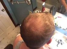 PURC-pulverizador para el crecimiento del cabello para hombres y mujeres, tratamiento para la pérdida de cabello de rápido crecimiento, productos de belleza para el cuidado del cabello, 30ml