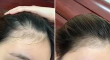Liquid Spray Hair-Loss-Products Essential-Oil Dry-Hair Omy Lady Regeneration-Repair 