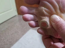 Parches médicos para el cuidado de los pies, almohadillas de eliminación de maíz, espinillas, parches curativos, elimina callosidades, desintoxicación, 30 Uds.