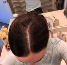 HAIRCUBE-esencia para el crecimiento del cabello para hombres y mujeres, suero para el crecimiento del cabello, Germinal rápido, cuidado del cabello, reparación, líquido antipérdida de cabello más grueso