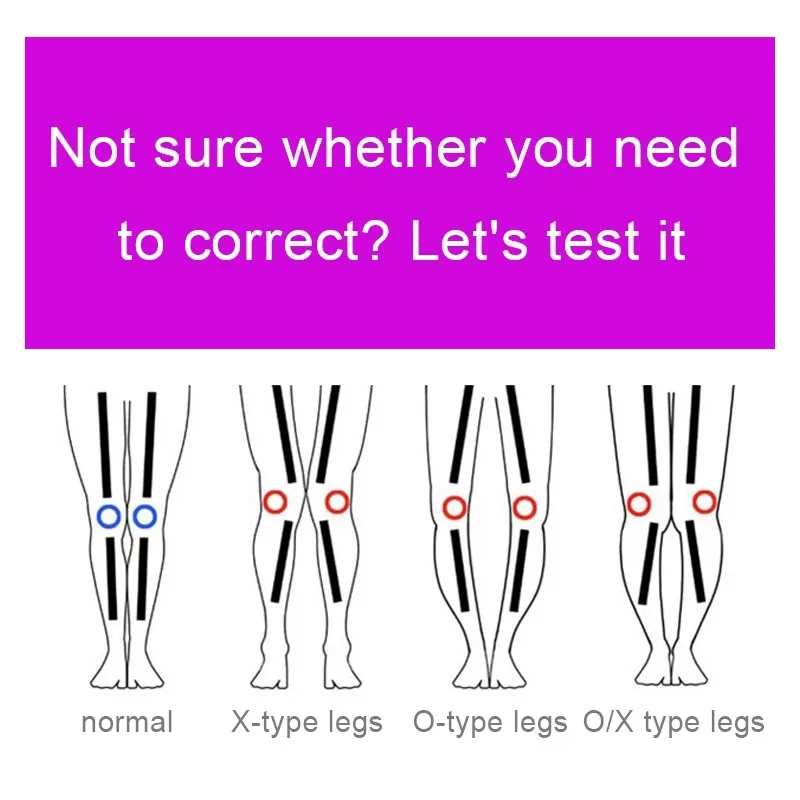 Ортопедические фиолетовые 3 шт./компл. Корректор осанки о ног/X тип бандаж