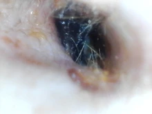 Endoscopio de limpieza de orejas, herramienta boroscopio para el cuidado de la salud, endoscopio, USB, Visual, 5,5mm, cámara de 0.3MP, Android, PC