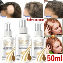 

Soomiig Hair Growth Spray Serum Natural Anti Hair Loss Products Fast Growing Prevent Baldness Treatment Germinal Liquid
