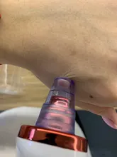 Aparato para limpieza profunda de la piel con espinillas, limpiador con punta de diamante de Zona T para nariz y resto del rostro, para la eliminación de espinillas, succión al vacío