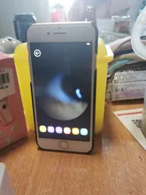 Clean-Skin-Tool Pore-Acne-Pimple-Removal Blackhead-Remover Deep-Nose-Cleaner Vacuum-Suction