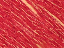 Microscope-Camera Trinocular Digital Electronic-Eyepiece CMOS 5MP USB HD for Free-Driver