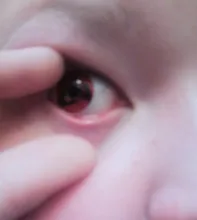 Lentes de contacto Sharingan para Cosplay, Lentes rojas de colores para ojos, Uchiha Sasuke, Hatake, Kakashi