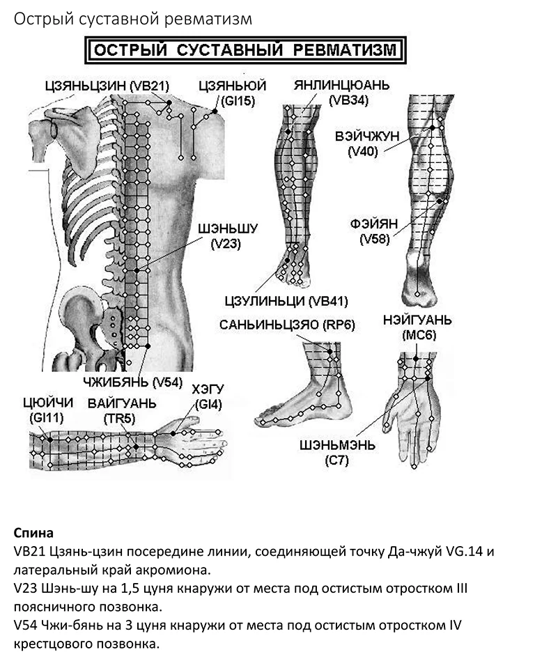 рефлексотерапия рецепты. рефлексотерапия показания. точки для иглоукалывания на спине. таблица акупунктурных точек для иглотерапии. доказанные характеристики точки рефлексотерапии.
